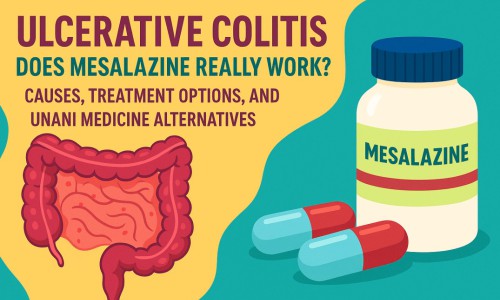 Ulcerative Colitis: Does Mesalazine Really Work? Causes, Treatment Options, and Unani Medicine Alternatives